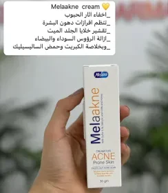 كريم ميلاكـن (Melaakne Cream)